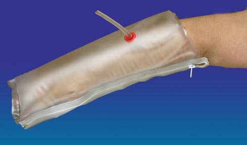 Inflatable Half-Arm Splint 25 - Transparent Vinyl, Immobilizing Orthop ...