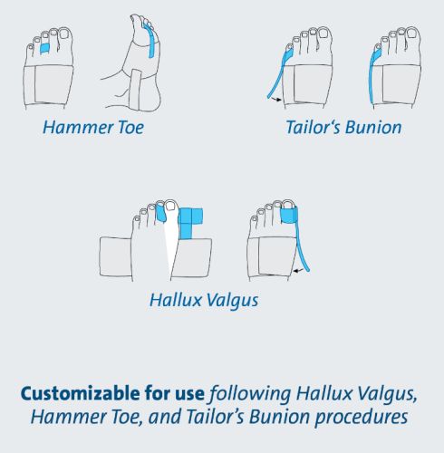 Darco Toe Alignment Splint - Post-Op Hallux Valgus, Hammer Toe Correction - One Size Fits All